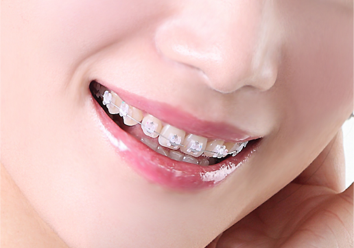 웃는사람의 치아