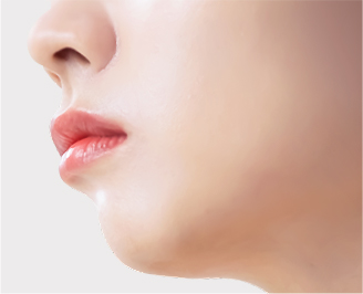 돌출입 턱모양